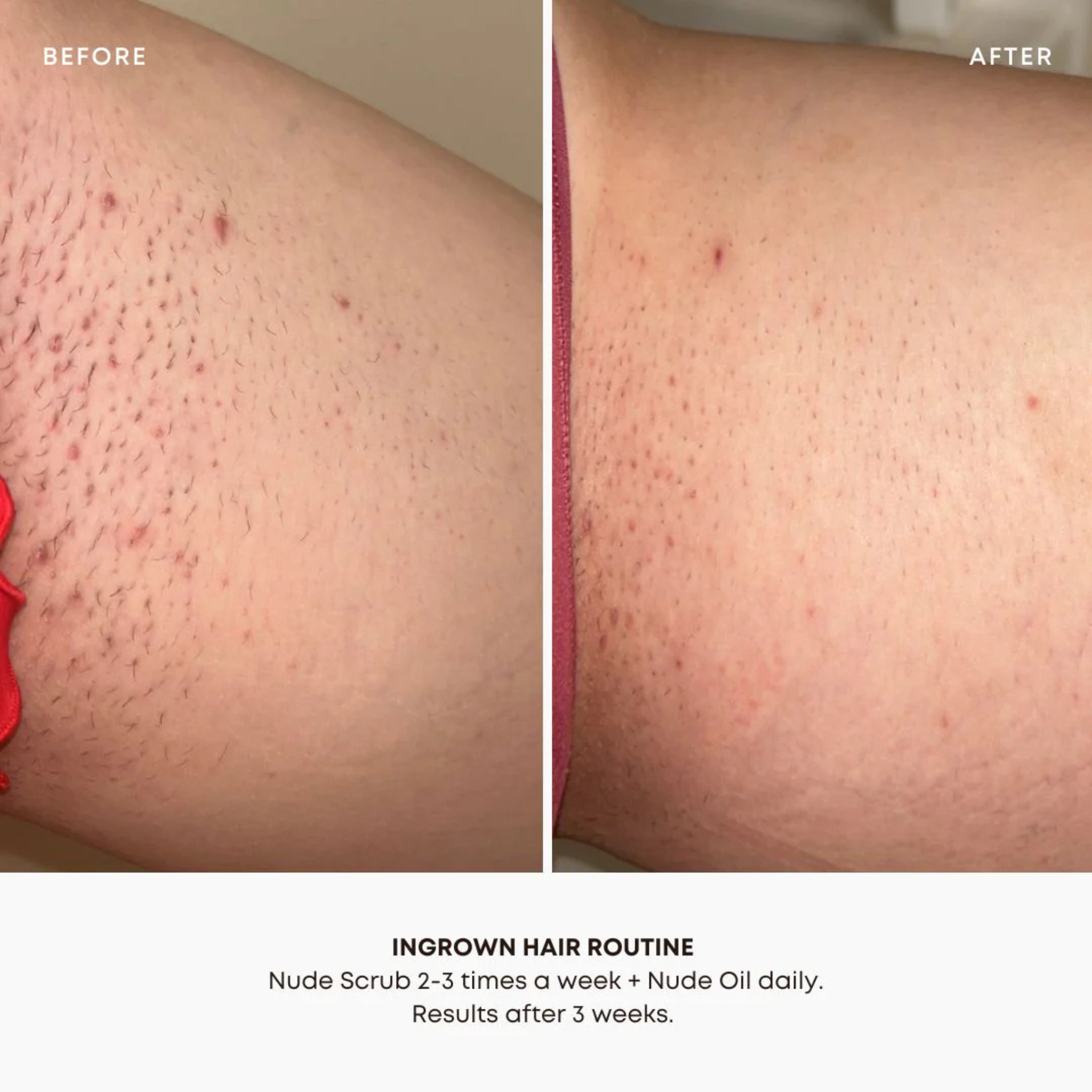 Bushbalm - Ingrown Hair Exfoliating Scrub Nude - 236ml