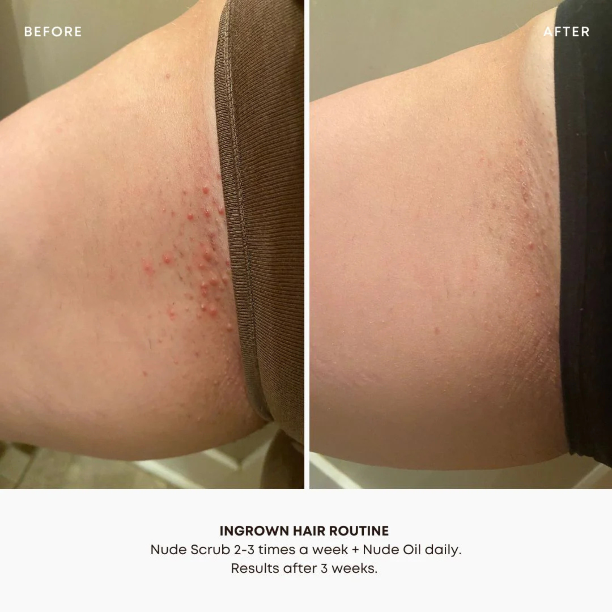 Bushbalm - Ingrown Hair Exfoliating Scrub Nude - 236ml